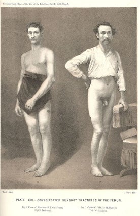 Medical and Surgical History of the War of the Rebellion; Surgical History