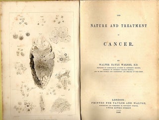 Nature and Treatment of Cancer