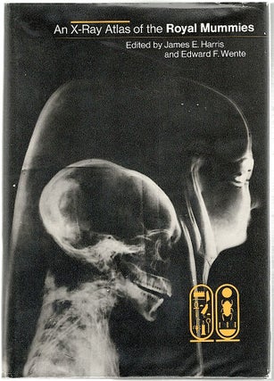 Item #491 X-Ray Atlas of the Royal Mummies. James E. Harris, Edward F. Wente